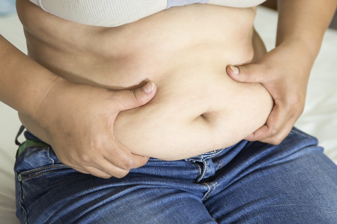 kaip prarasti pilvo riebalų prijuostę ką turite omenyje turėdamas svorio