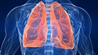 plaučių uždegimas svorio netekimas 1 800 degina riebalus