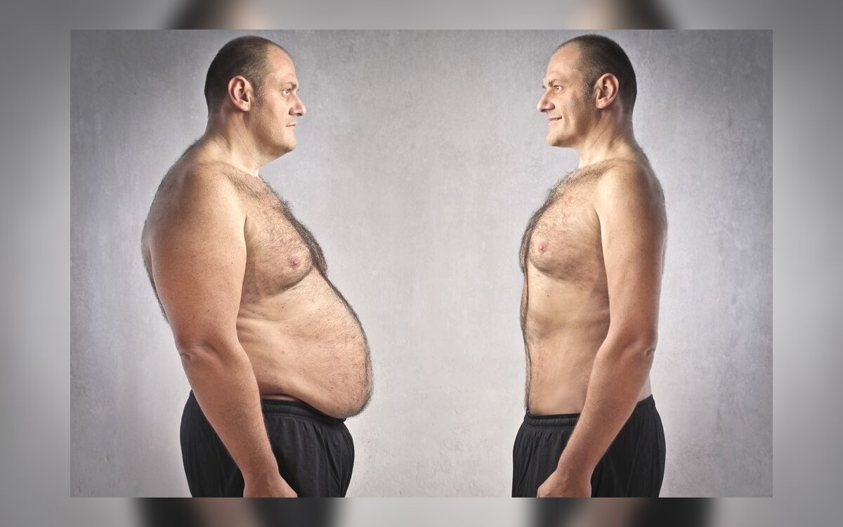 sunkus pilvo riebalų nuostolis numesti svorio palatinas