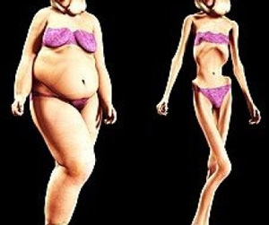 anoreksija nervosa svorio netekimas geriausias greitas riebalų deginimo papildas