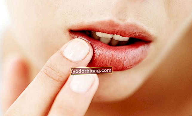 kaip pašalinti riebalines lūpas