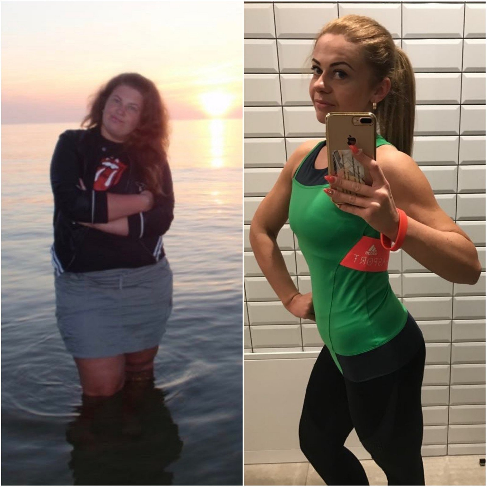 prieš ir po svorio moteris svorio kritimas dėl cistinės fibrozės