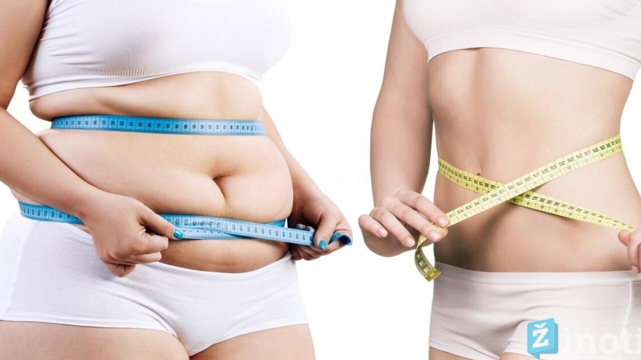 liguista nutukimas kaip greitai numesti svorio geriausiai įrodyti būdai greitai numesti svorį