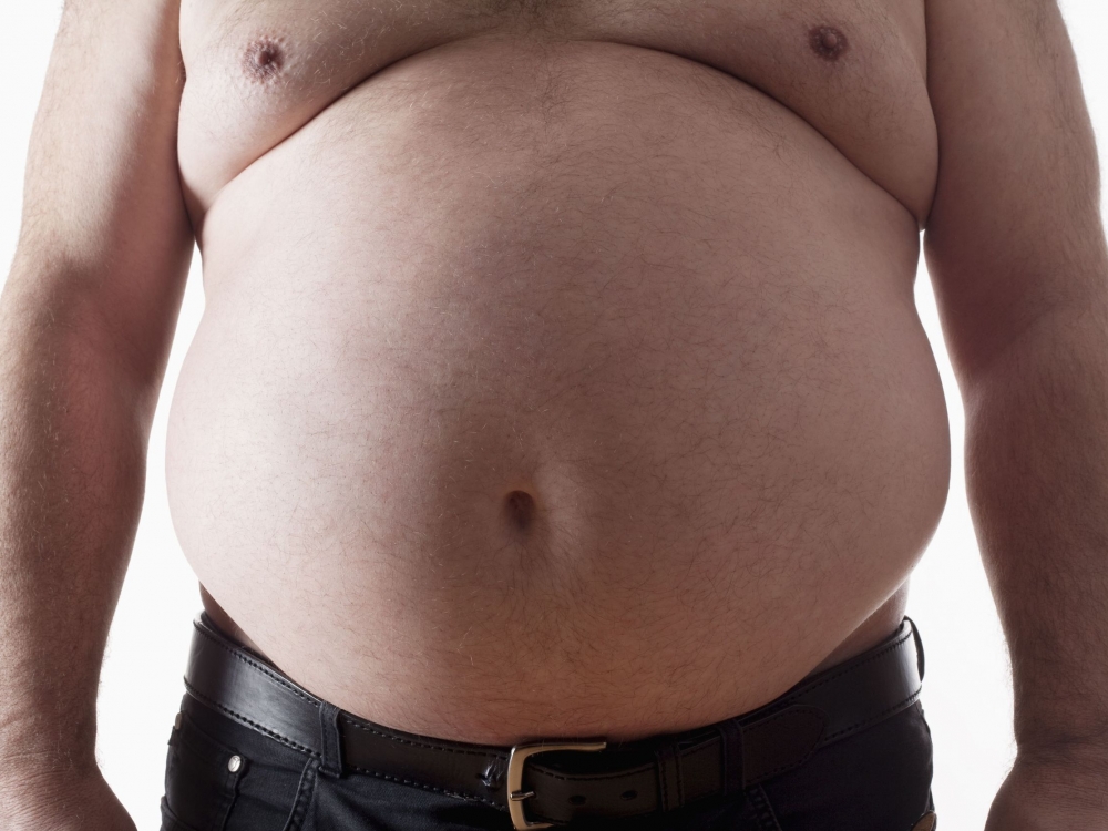 liguista nutukimas kaip greitai numesti svorio kaip pašalinti riebalų sankaupas
