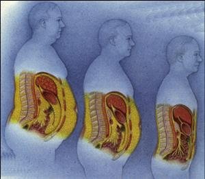 žmogaus kūno netekimas riebalų 22 metų svorio metimas